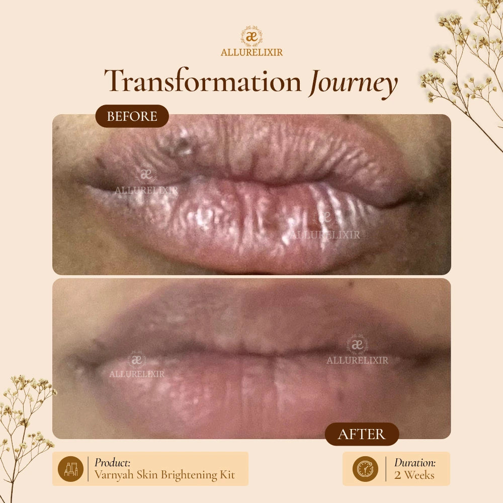 Varnyah: Lip Brightening Balm