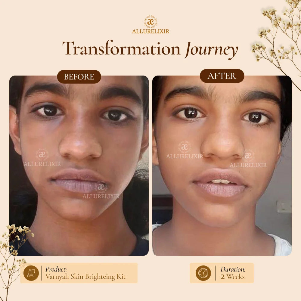 Varnyah : Face Brightening Kit