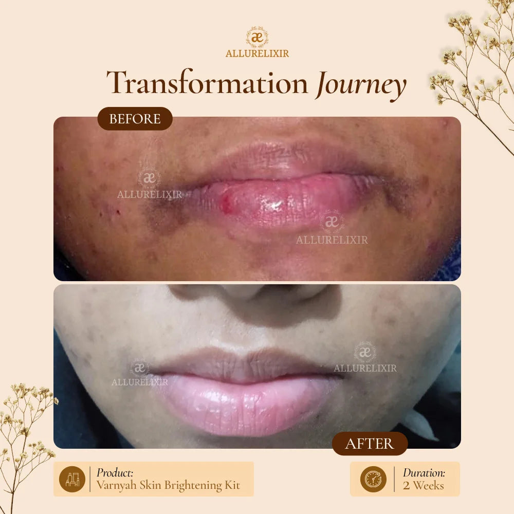 Varnyah : Face Brightening Kit