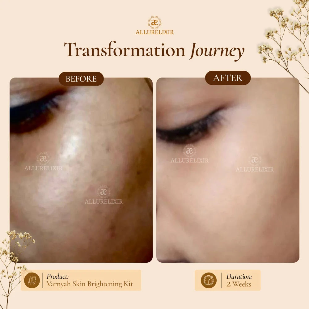 Varnyah : Skin Brightening Kit (Pack + Face Oil + Lip balm + Body Lotion)