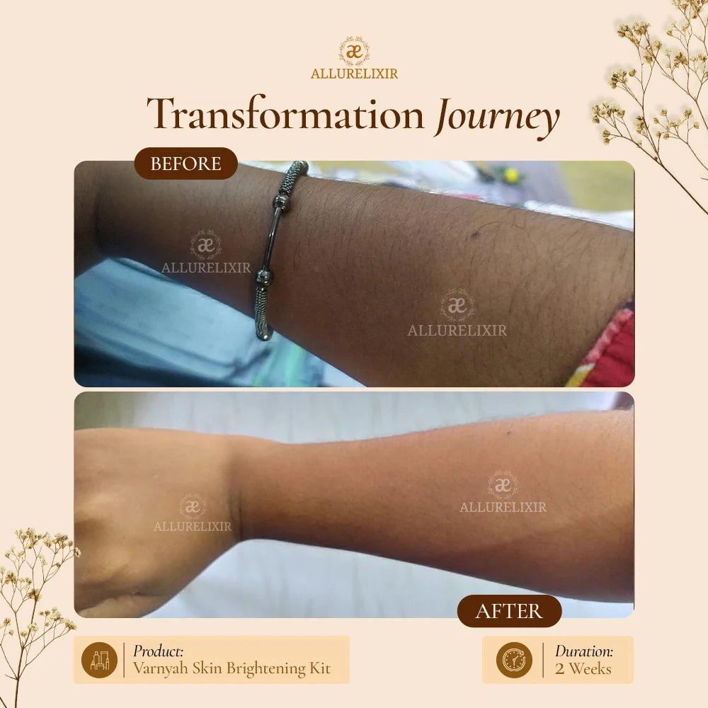 Varnyah : Skin Brightening Pack