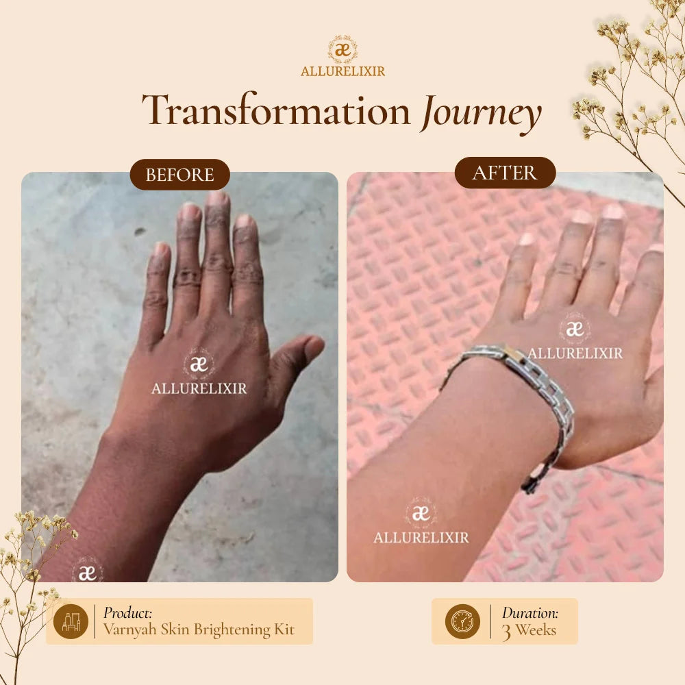 Varnyah : Skin Brightening Pack