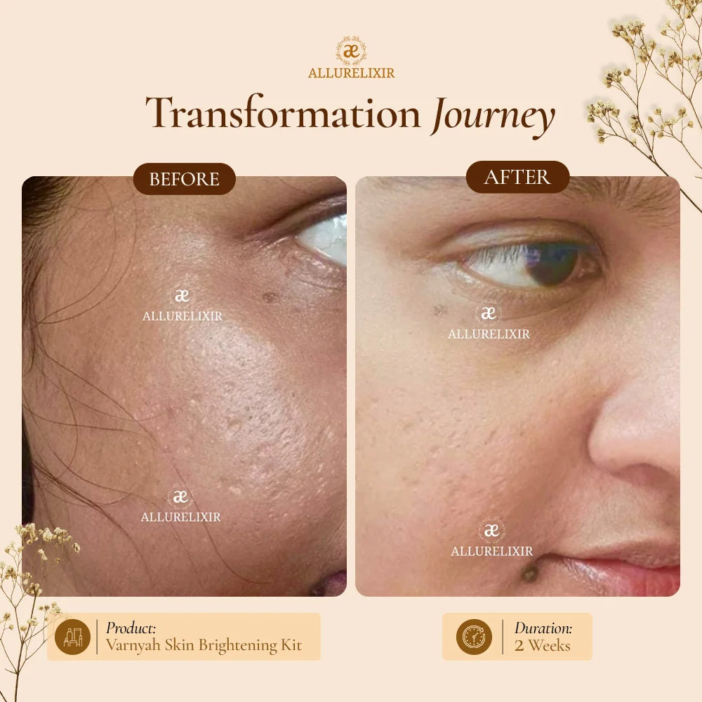 Varnyah : Skin Brightening Pack