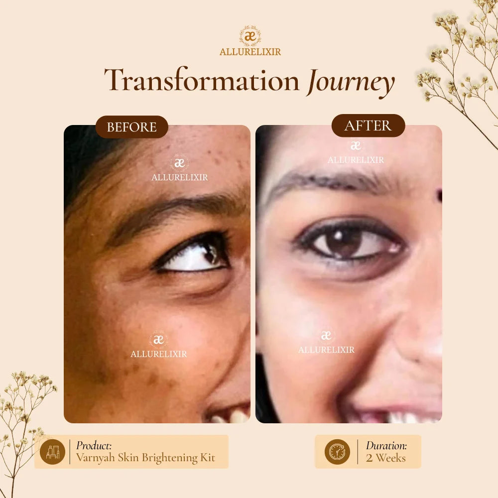 Varnyah : Skin Brightening Pack
