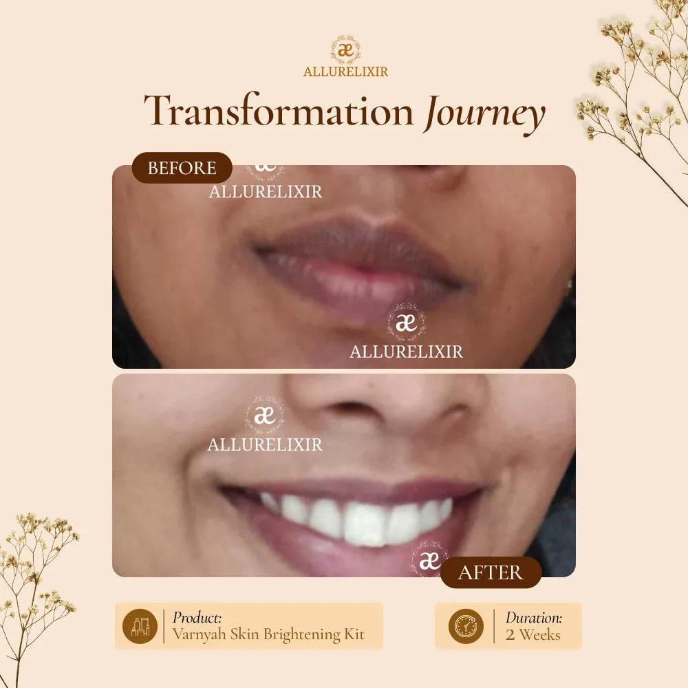Varnyah : Face Brightening Kit