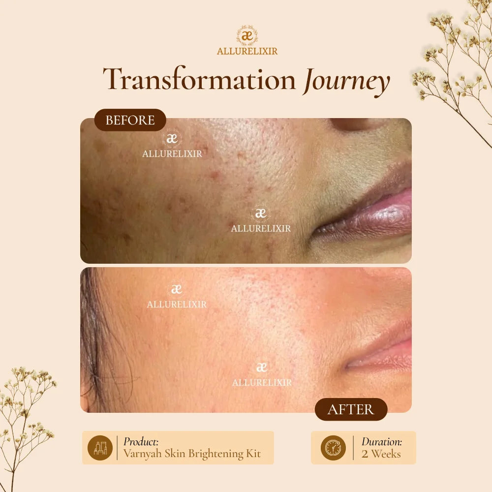 Varnyah : Soap Free Face Wash ( Brightening + Anti Acne )