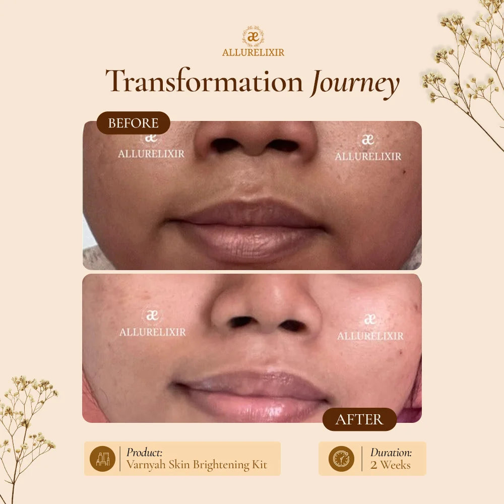 Varnyah : Face Brightening Kit
