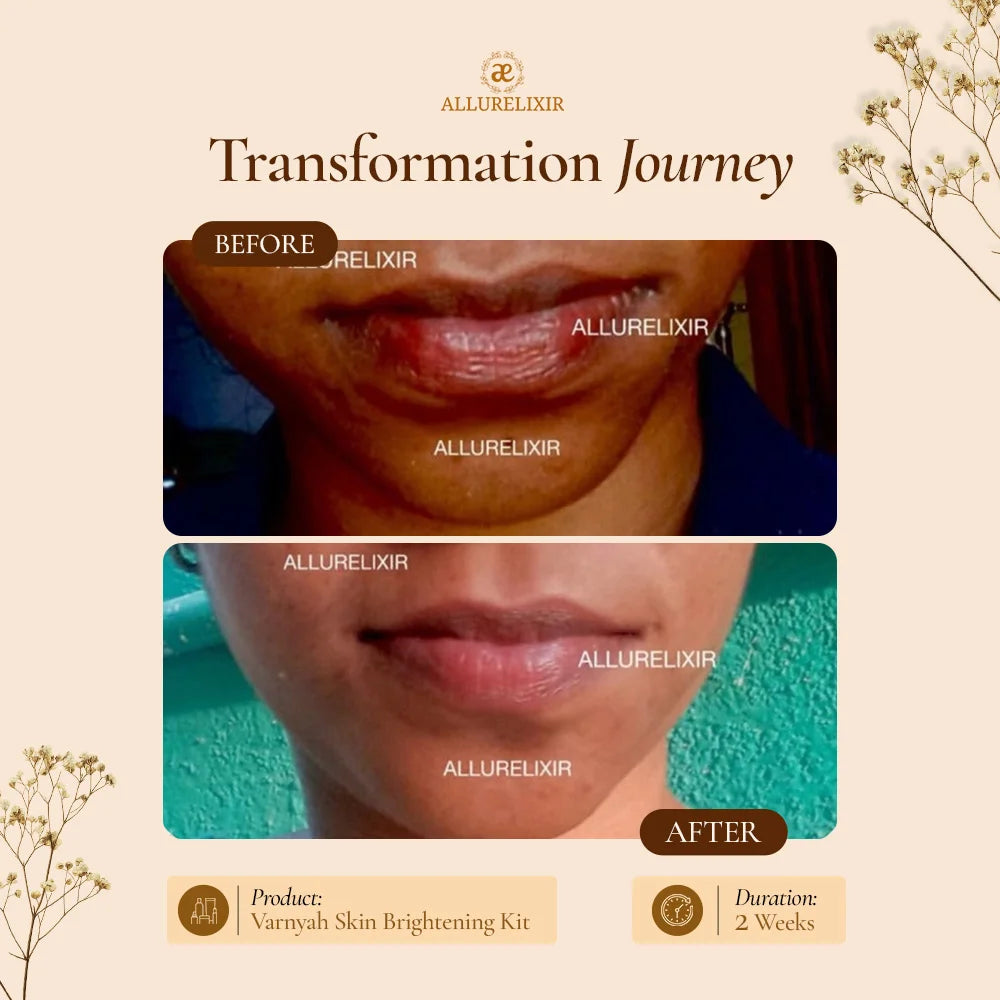 Varnyah : Face Brightening Duo