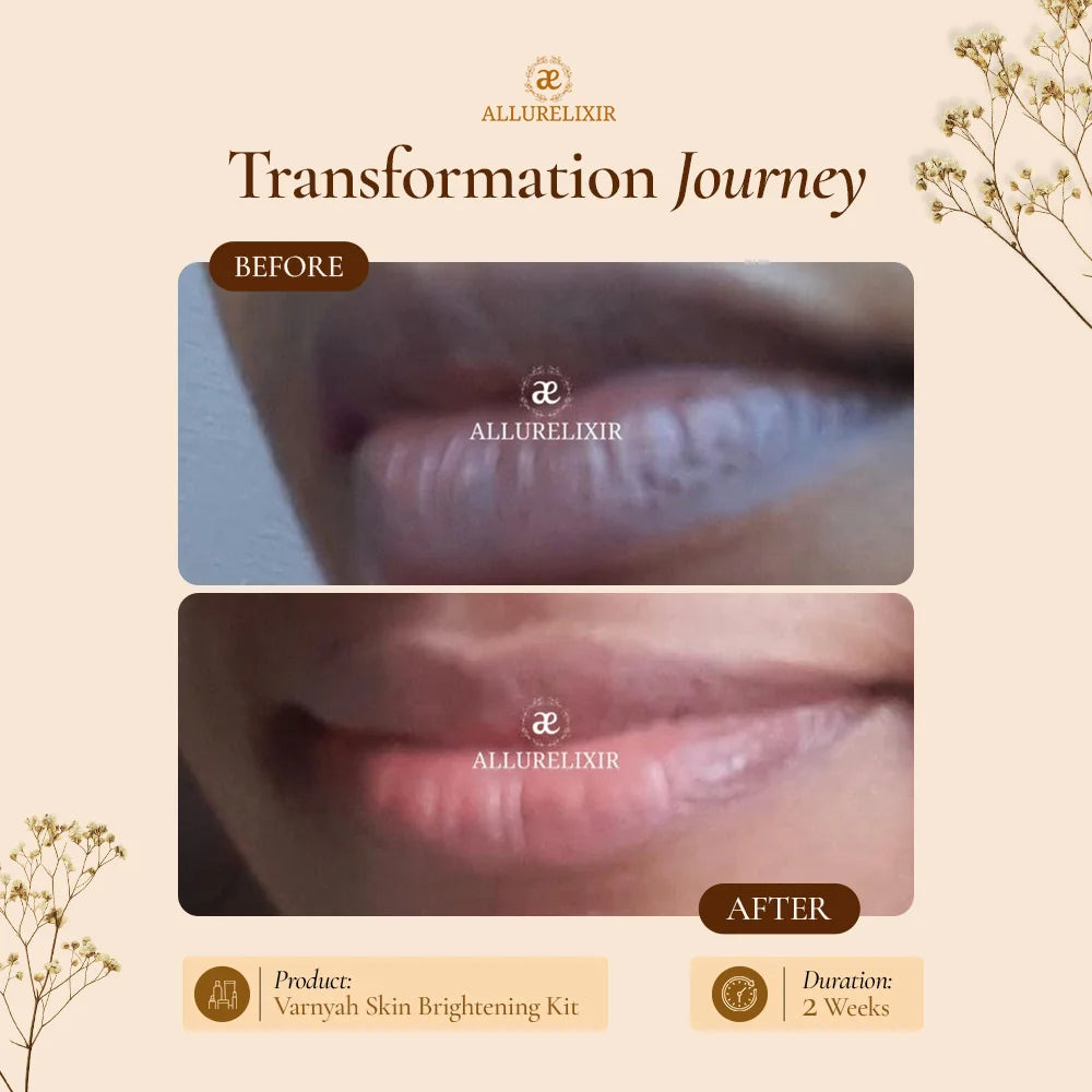 Varnyah: Lip Brightening Balm
