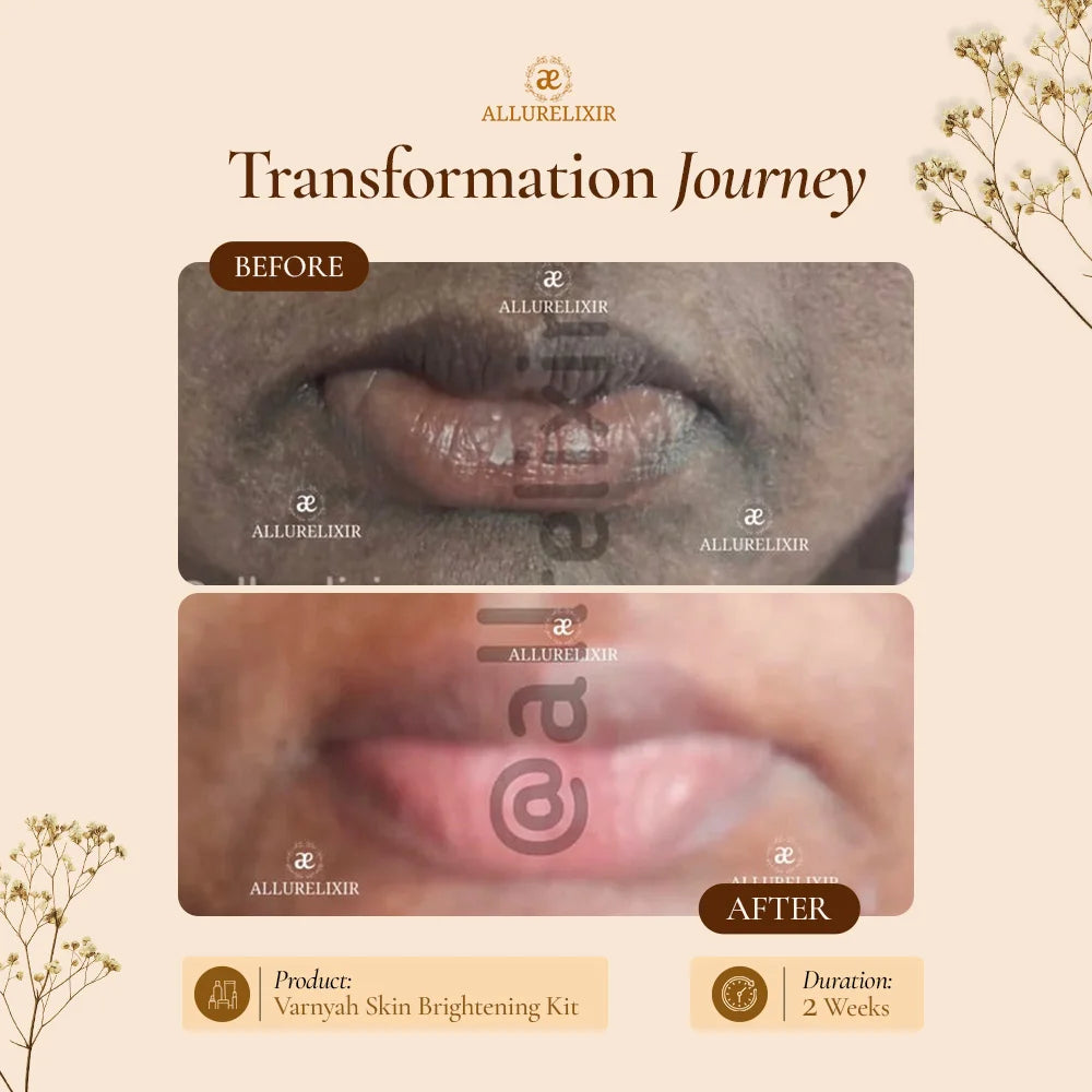 Varnyah : Face Brightening Kit