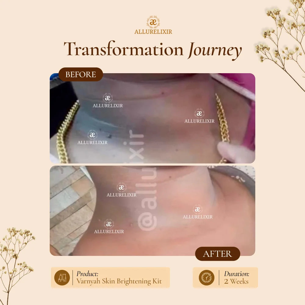 Varnyah : Skin Brightening Pack