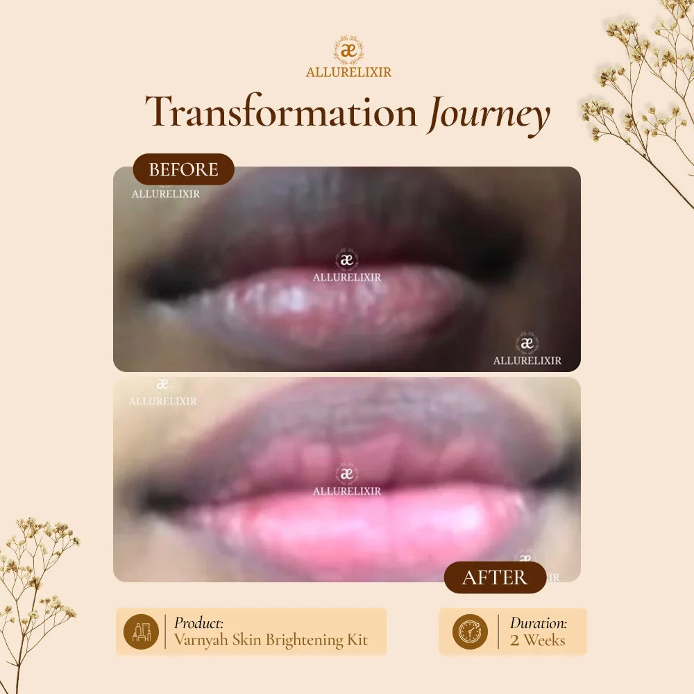 Varnyah : Face Brightening Kit