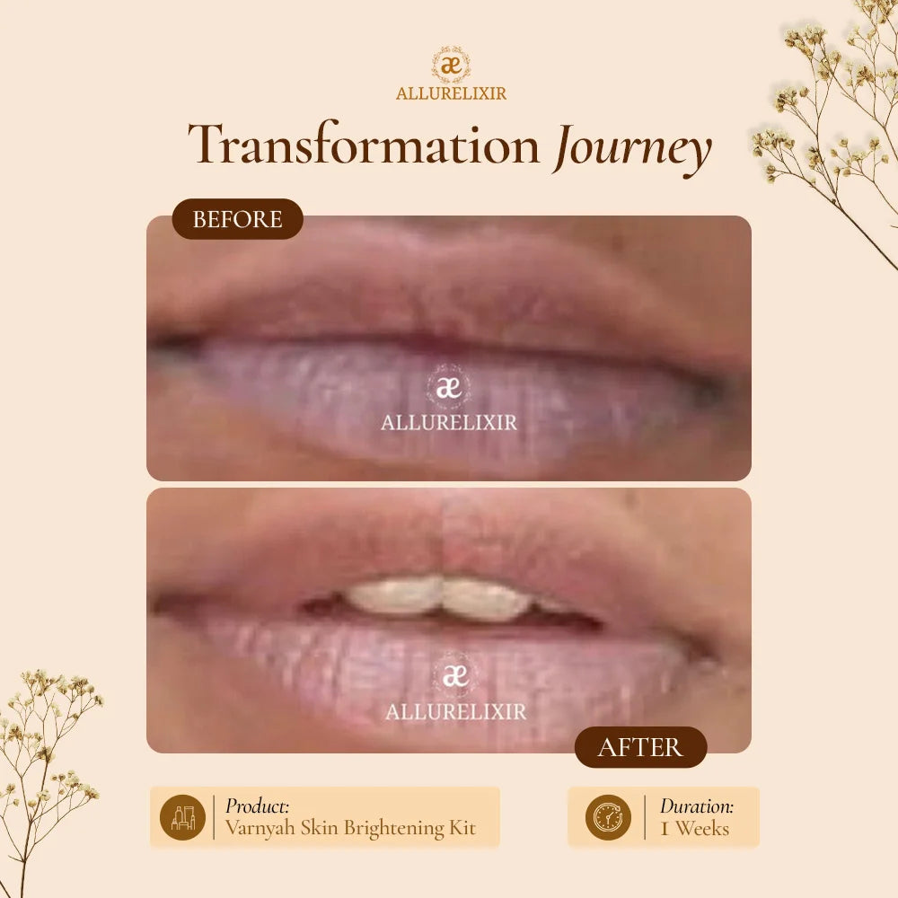 Varnyah: Lip Brightening Balm