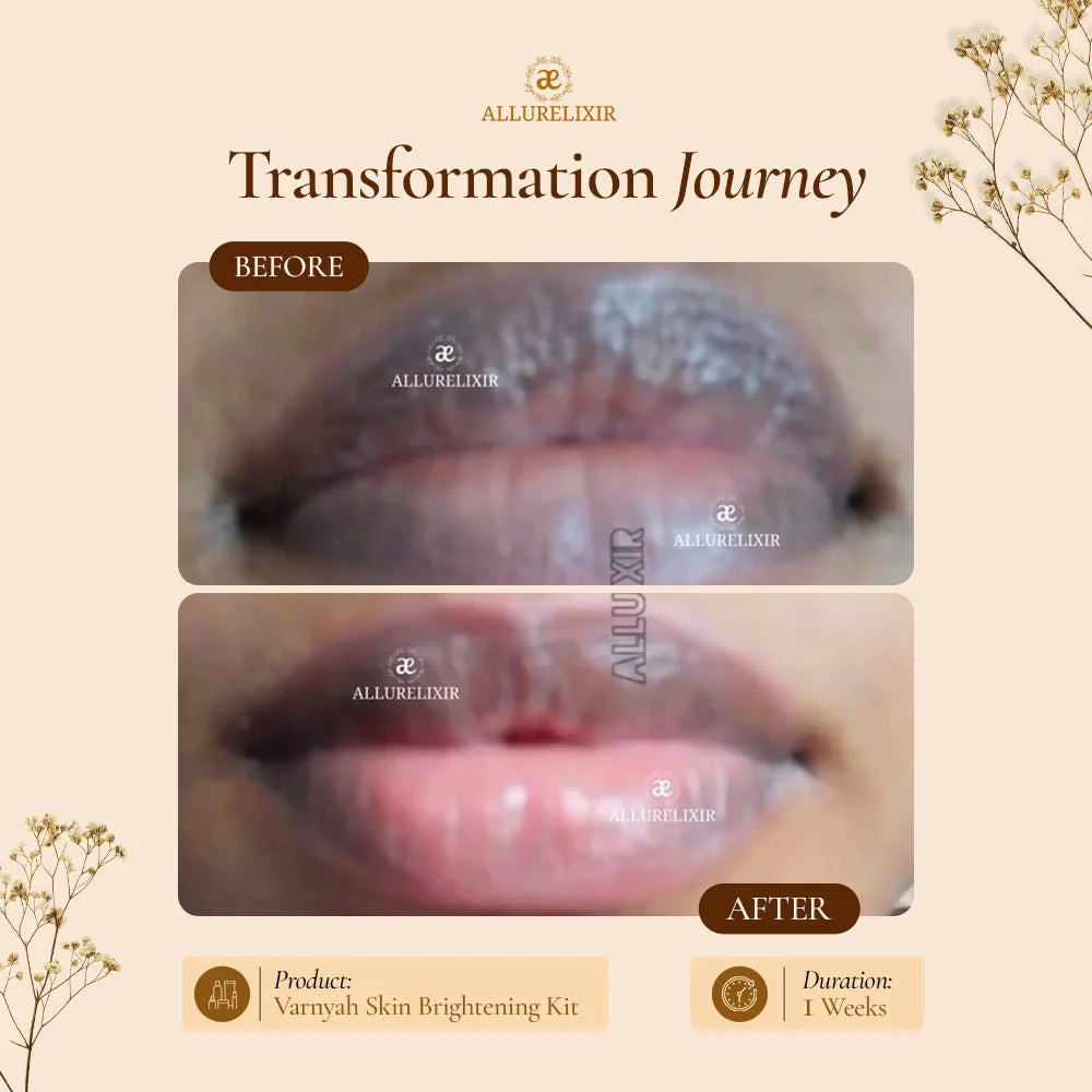 Varnyah: Lip Brightening Balm