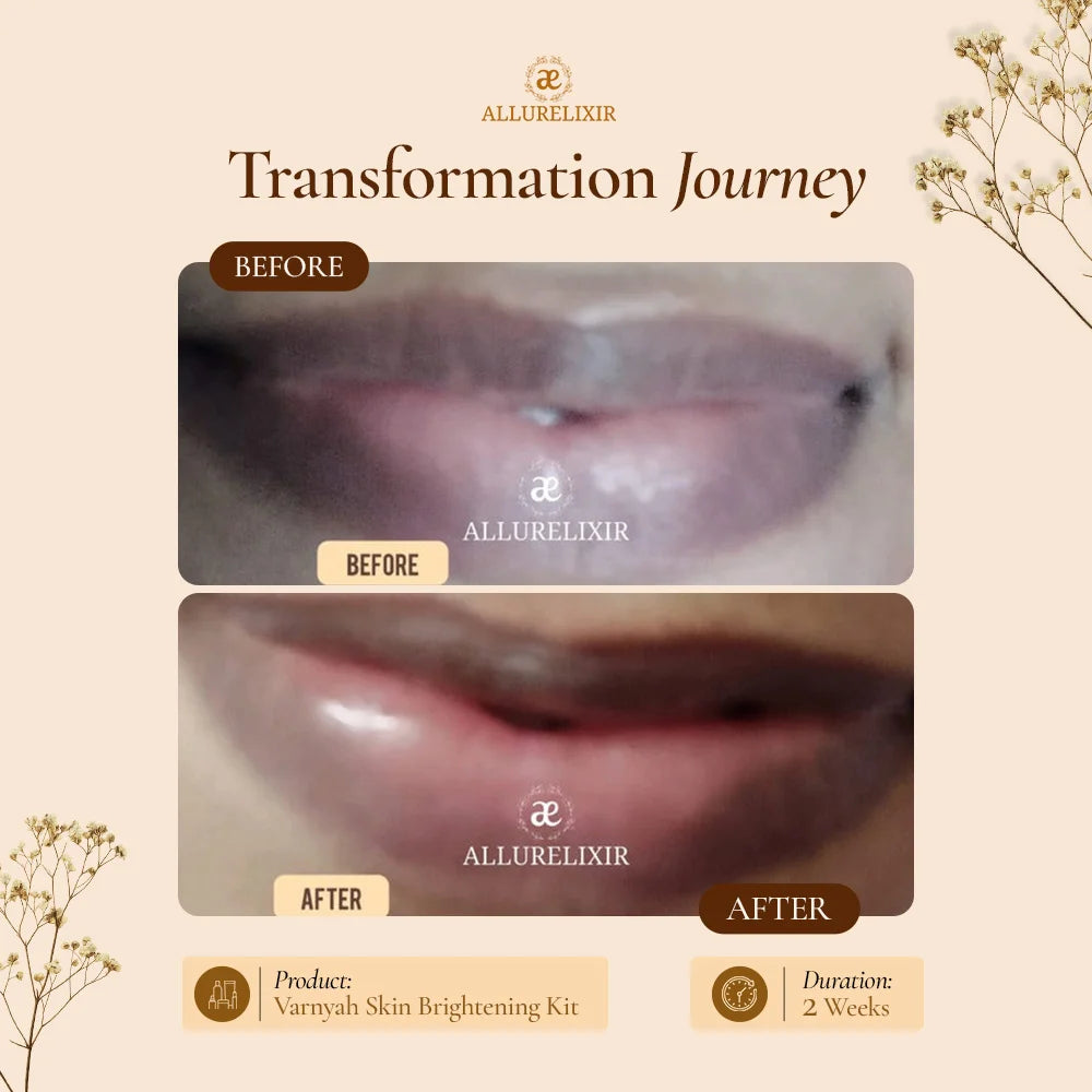 Varnyah: Lip Brightening Balm