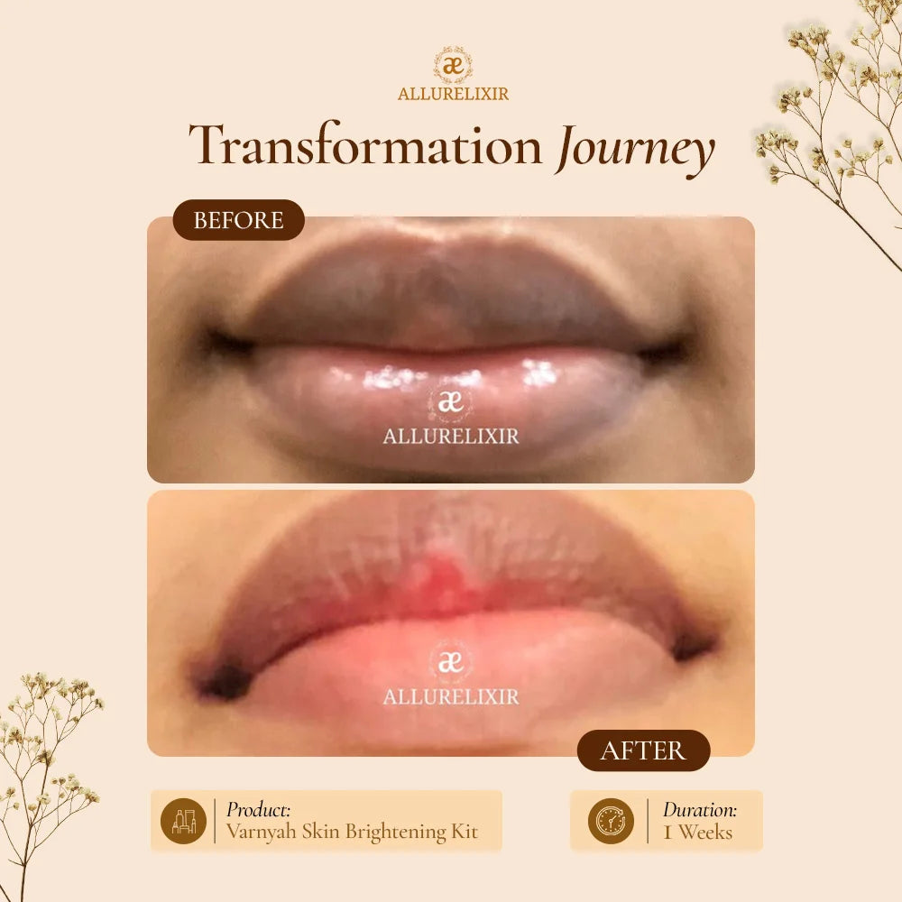 Varnyah: Lip Brightening Balm