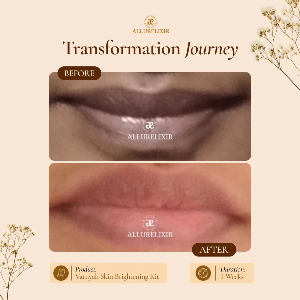 Varnyah: Lip Brightening Balm