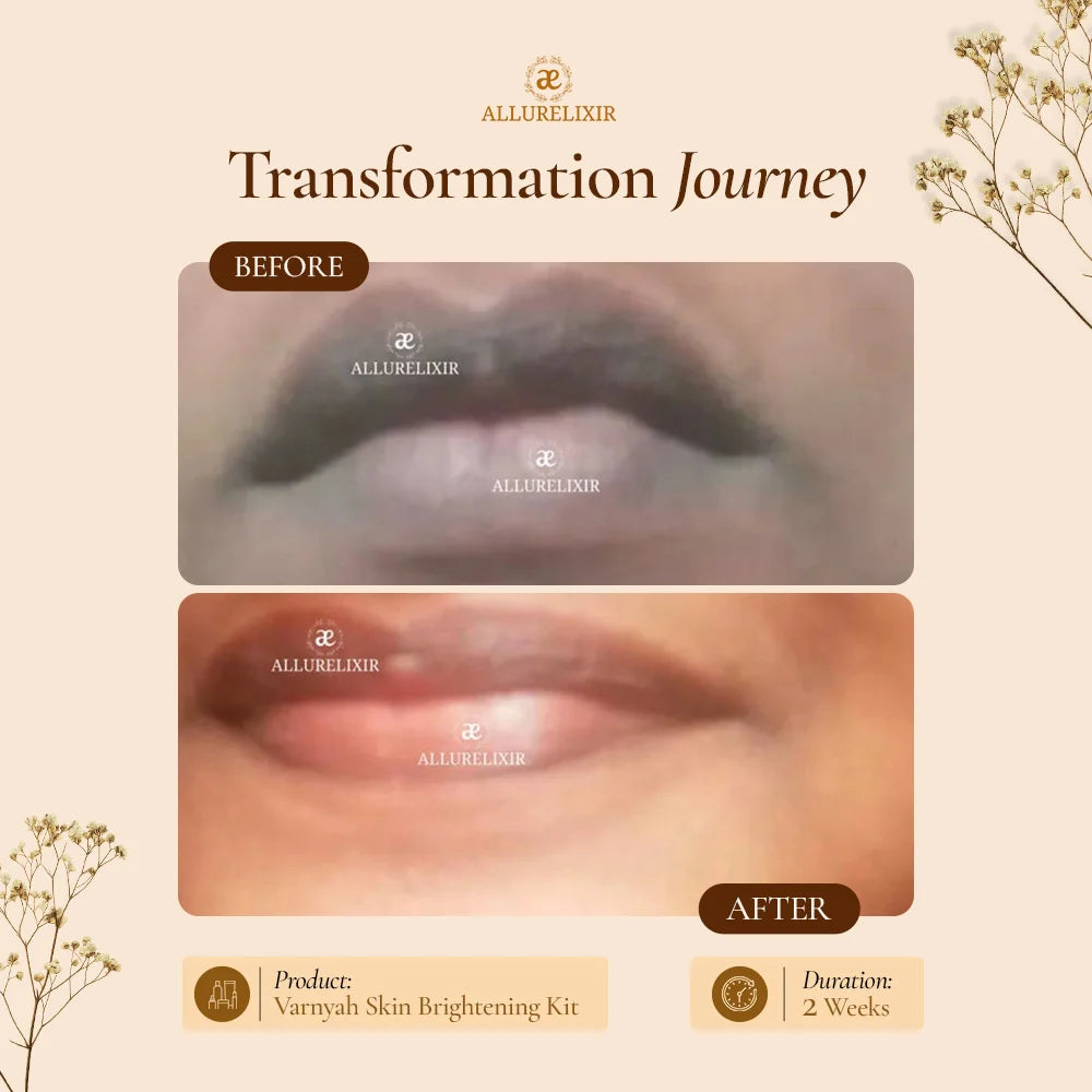 Varnyah : Face Brightening Kit
