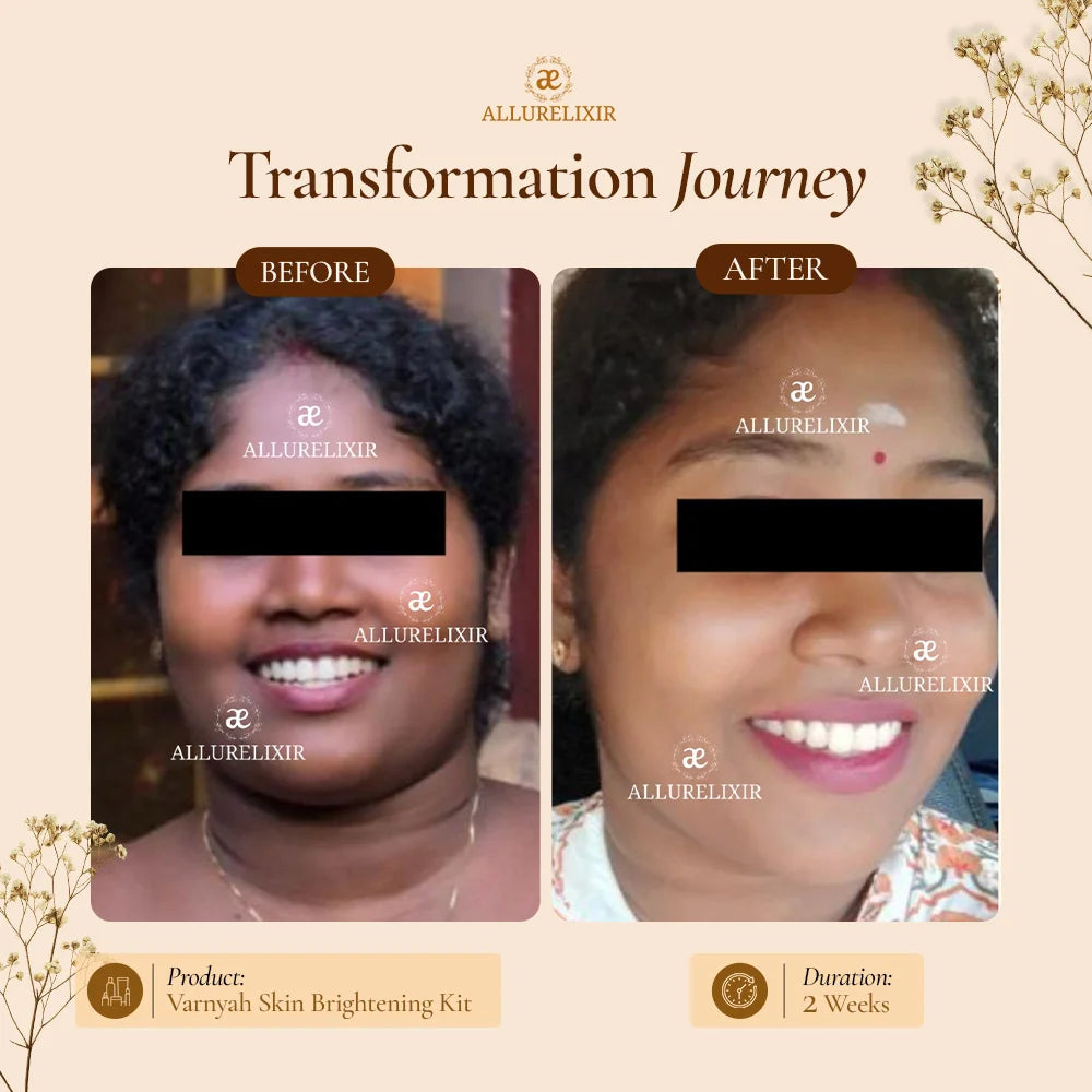 Varnyah : Face Brightening Kit