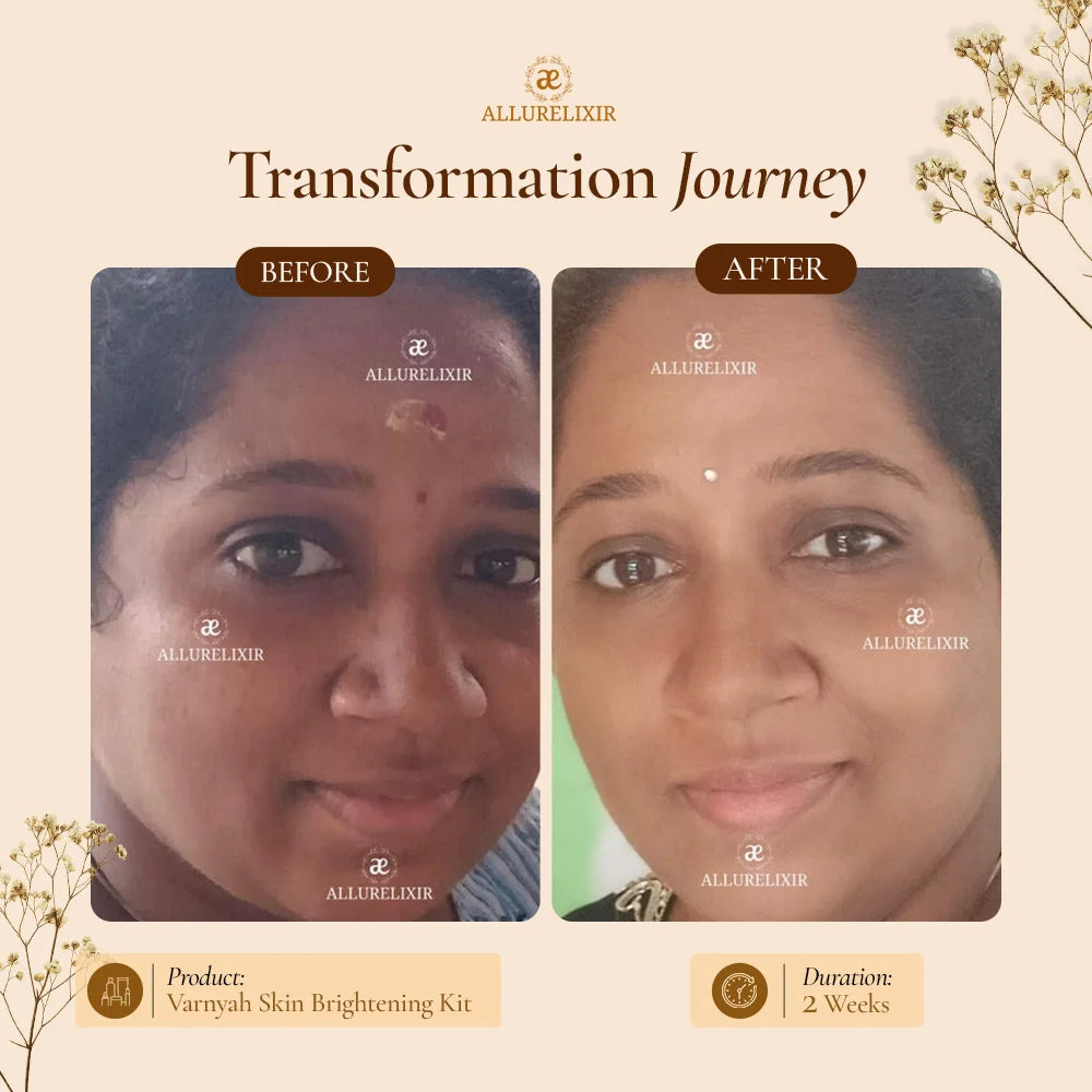 Varnyah : Face Brightening Oil ( Advanced Kumkumadi Oil )