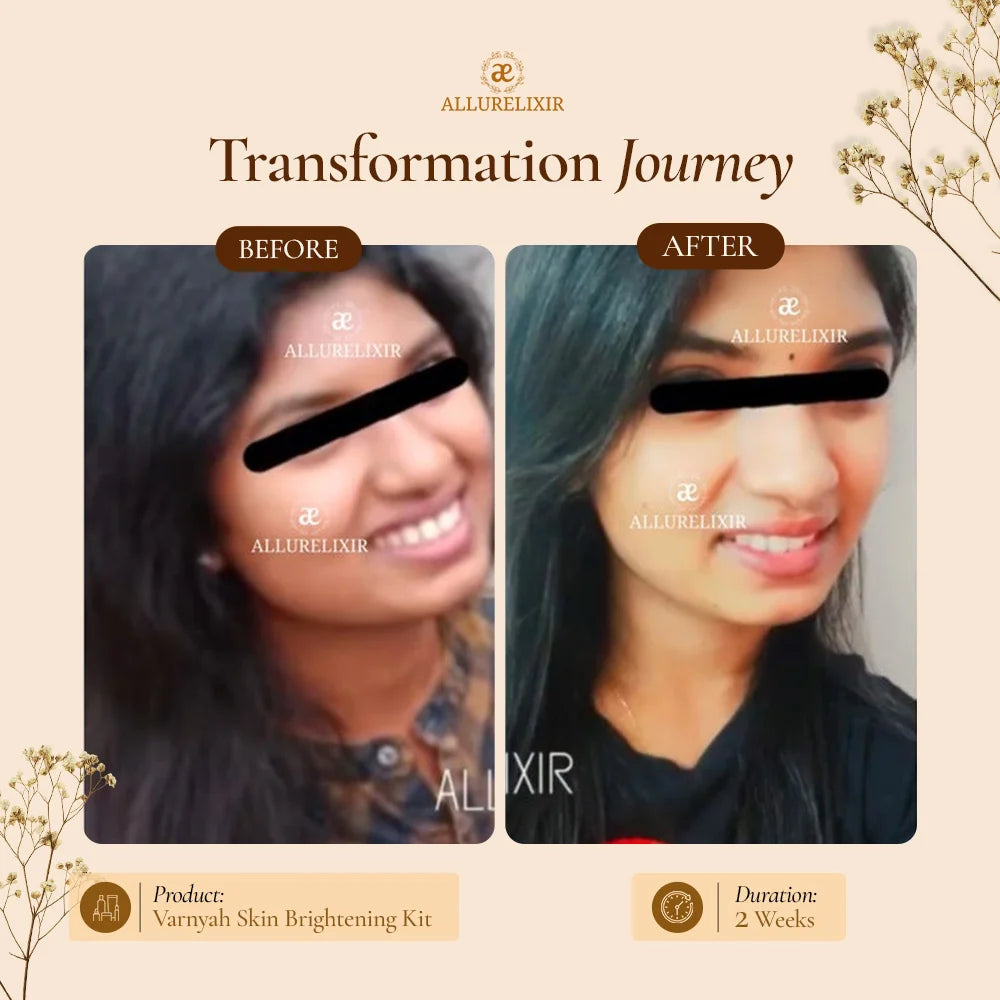 Varnyah : Face Brightening Kit