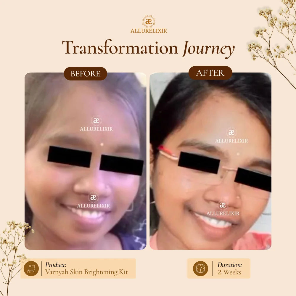 Varnyah : Face Brightening Kit