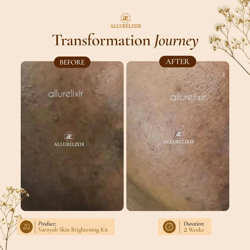 Varnyah : Face Brightening Oil ( Advanced Kumkumadi Oil )