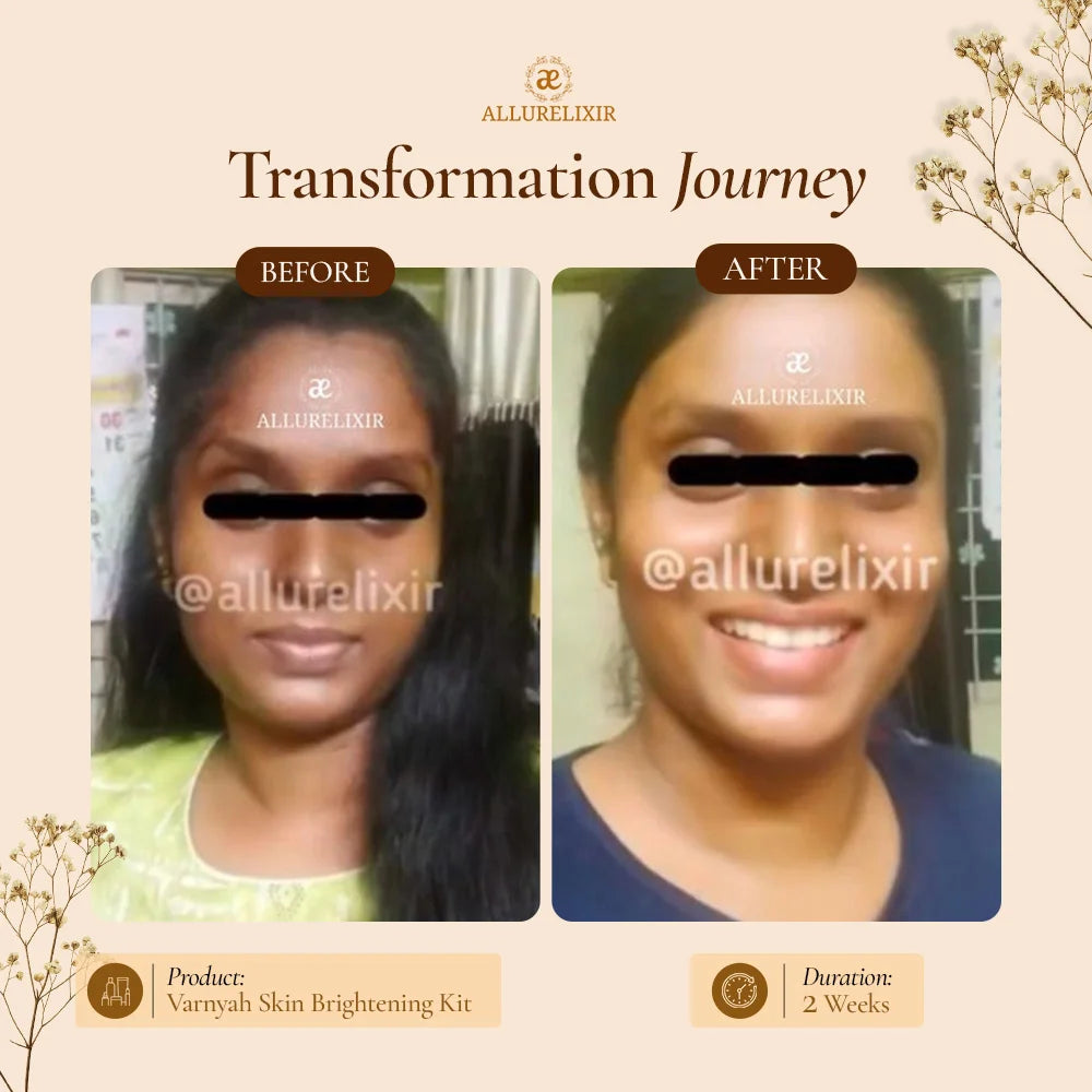 Varnyah : Face Brightening Kit