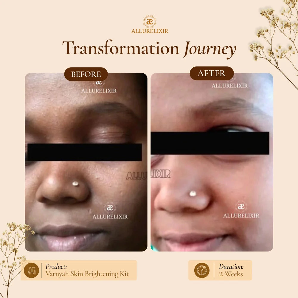 Varnyah : Face Brightening Kit
