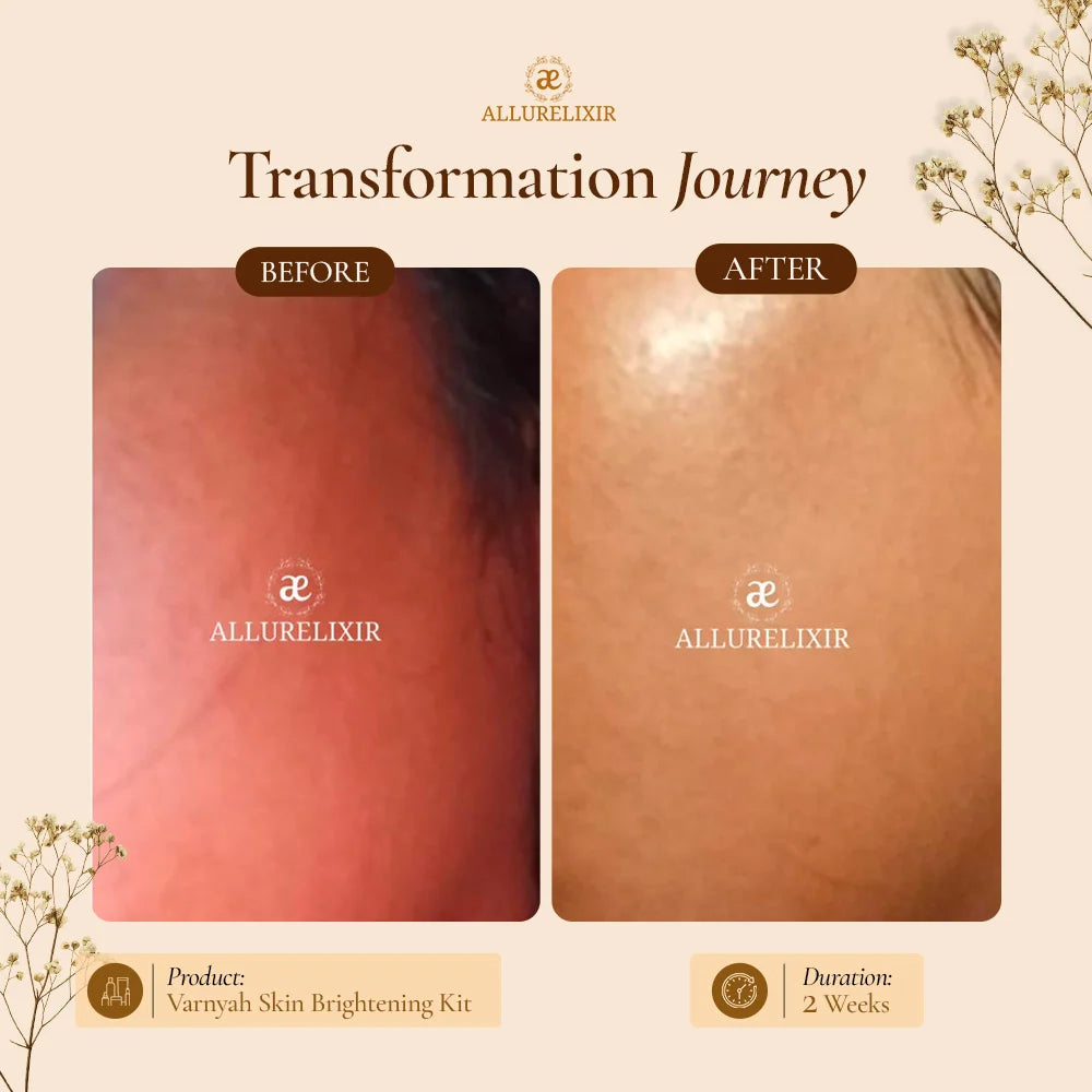 Varnyah : Skin Brightening Kit (Pack + Face Oil + Lip balm + Body Lotion)