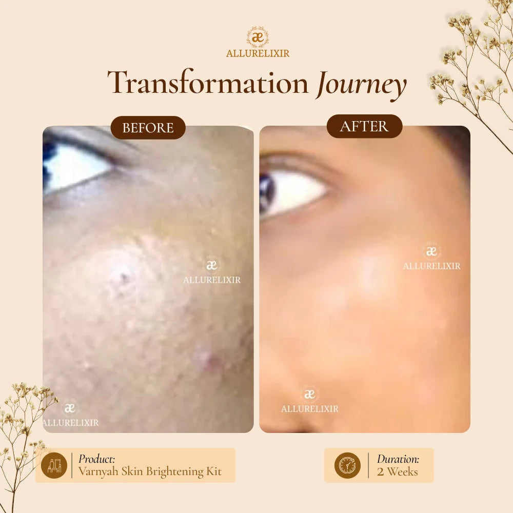 Varnyah : Skin Brightening Kit (Pack + Face Oil + Lip balm + Body Lotion)