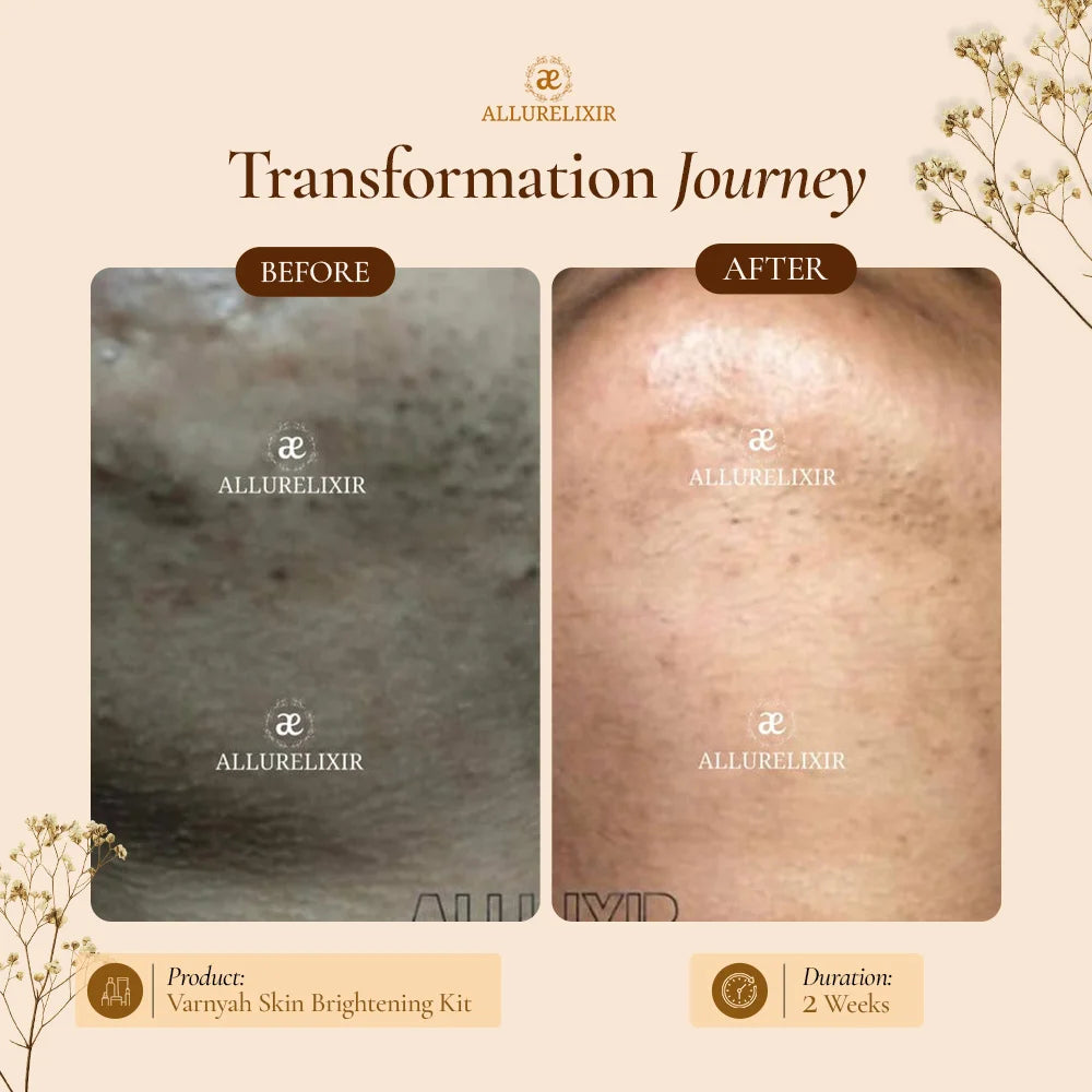Varnyah : Skin Brightening Pack