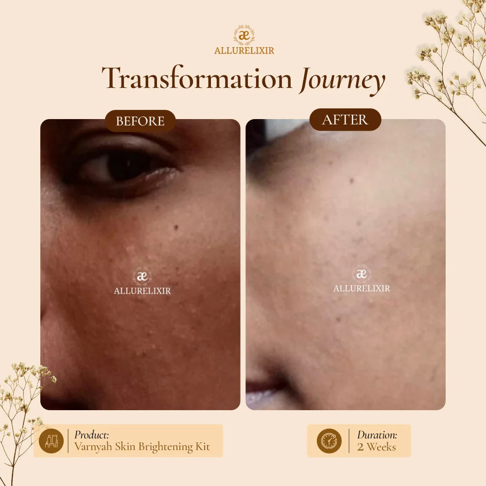 Varnyah : Skin Brightening Pack