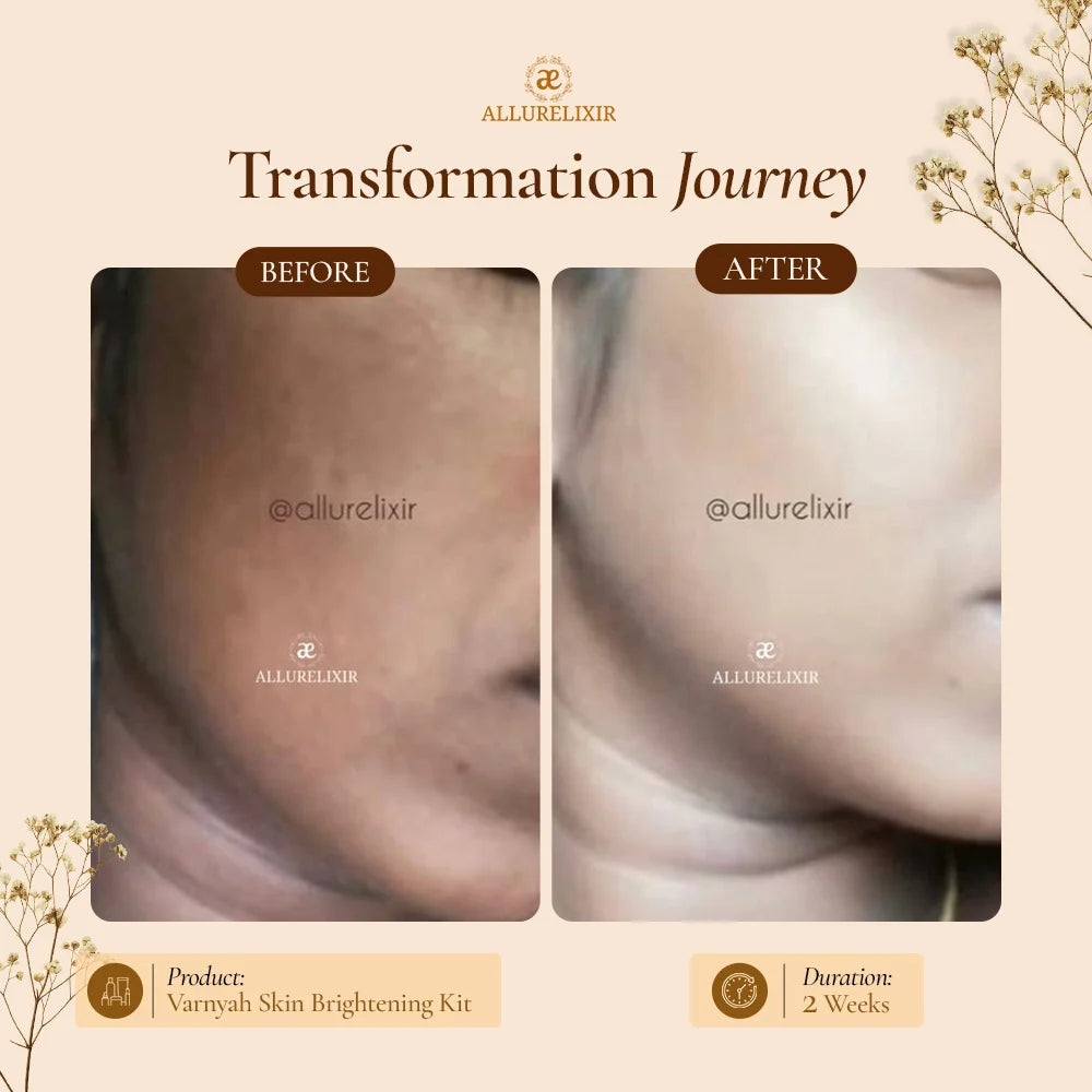 Varnyah : Face Brightening Oil ( Advanced Kumkumadi Oil )