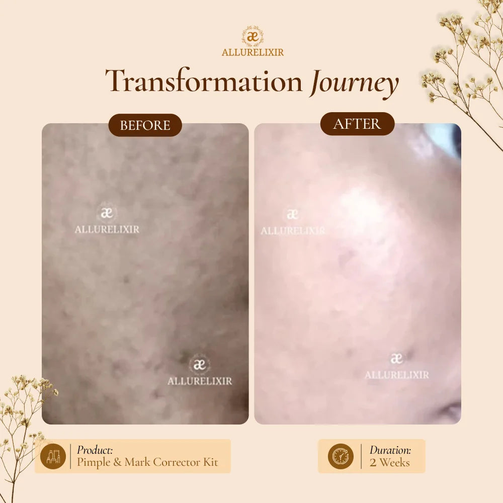 Brightening & Pimple Care Duo