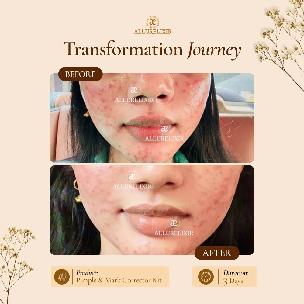 Brightening & Pimple Care Duo