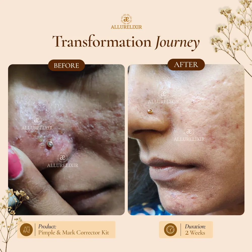 Brightening & Pimple Care Duo