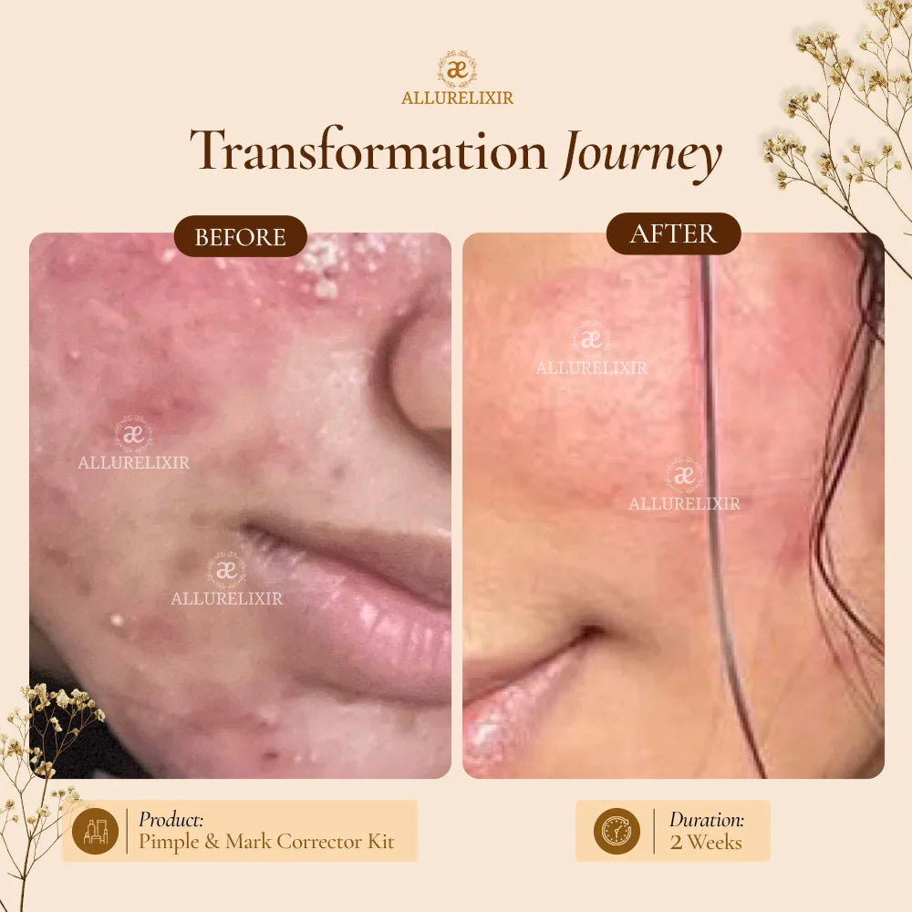 Brightening & Pimple Care Duo