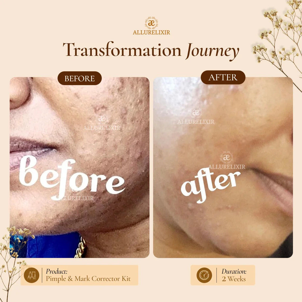 Brightening & Pimple Care Duo