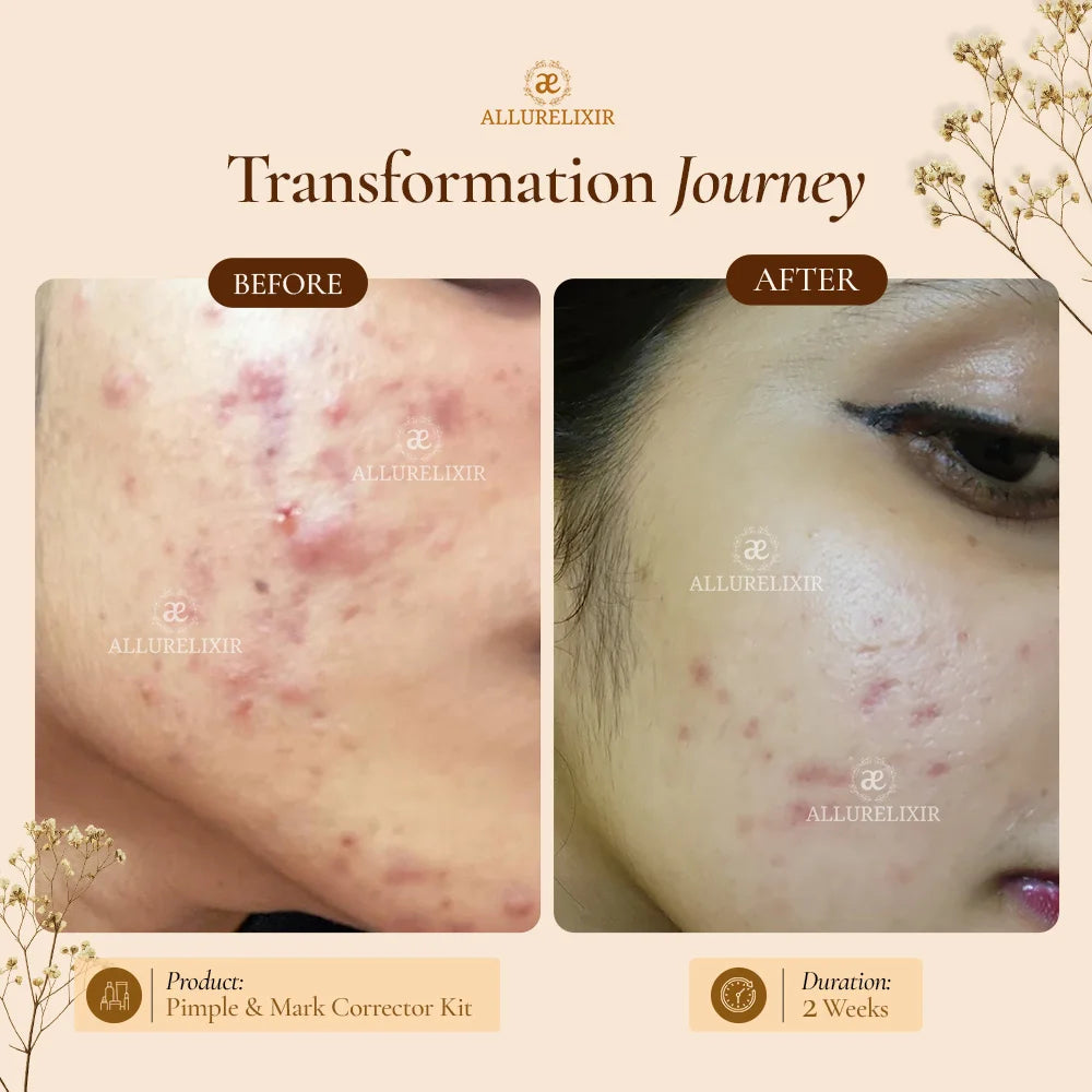 Brightening & Pimple Care Duo
