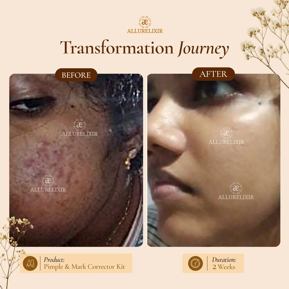 Brightening & Pimple Care Duo
