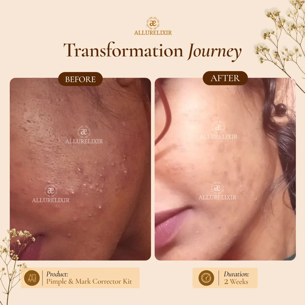 Brightening & Pimple Care Duo