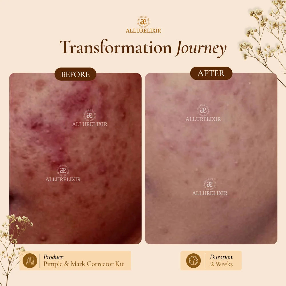 Brightening & Pimple Care Duo