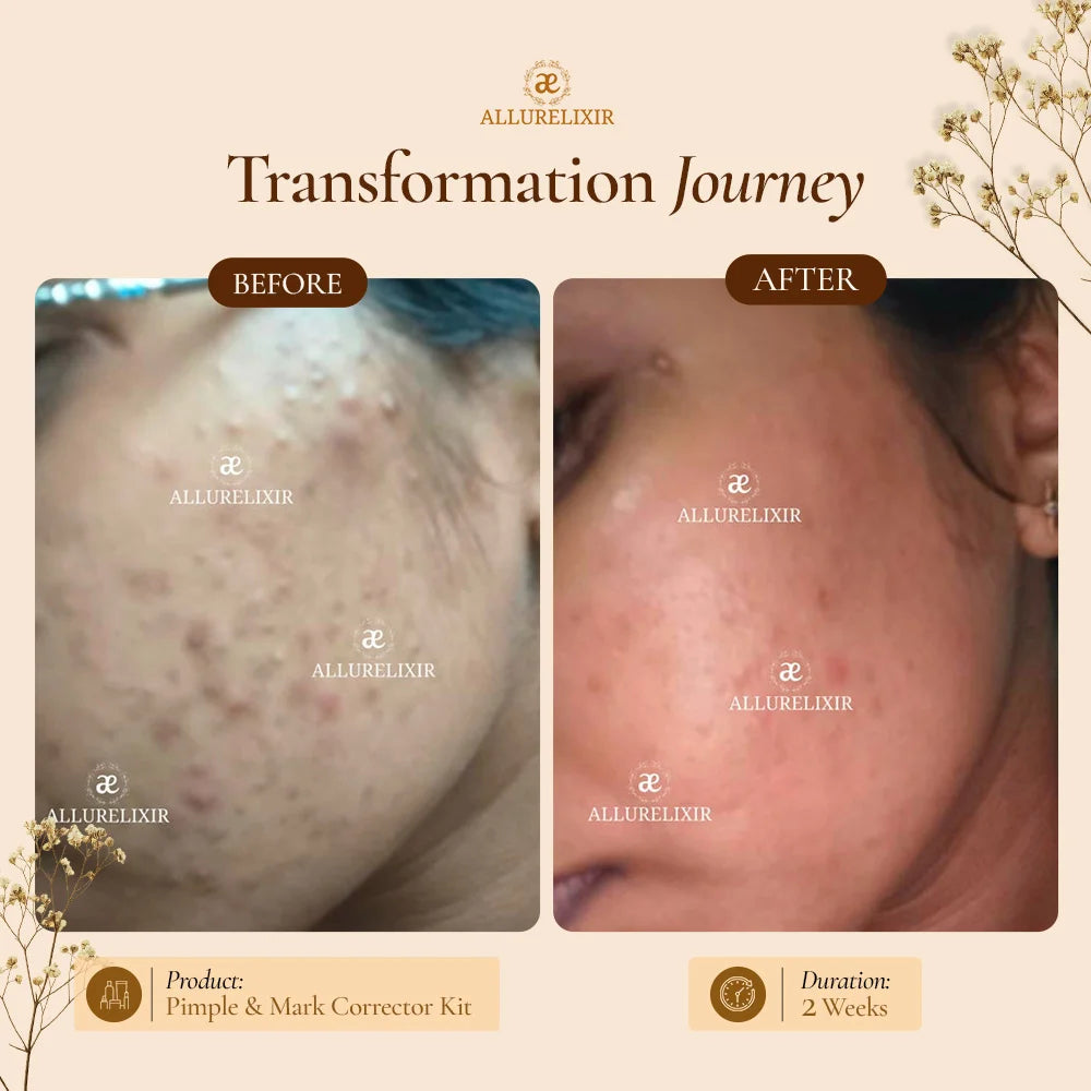 Brightening & Pimple Care Duo