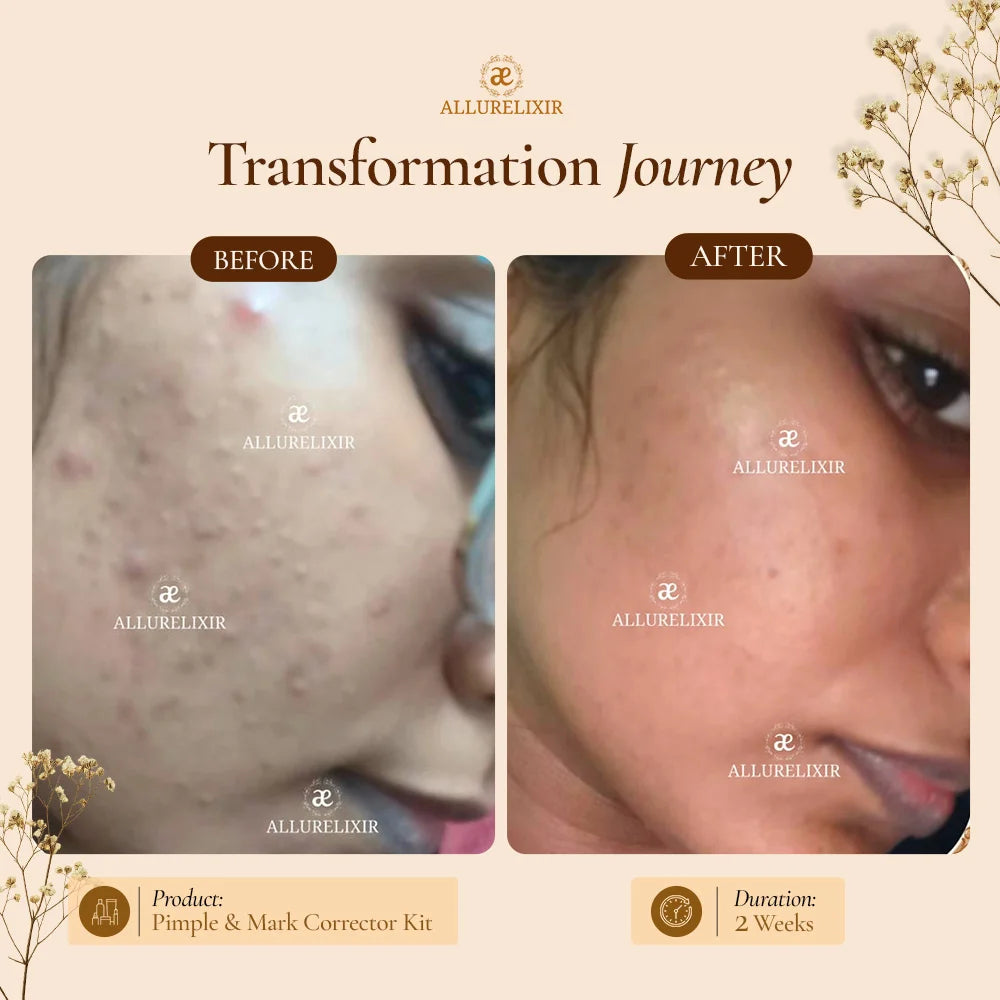 Brightening & Pimple Care Duo