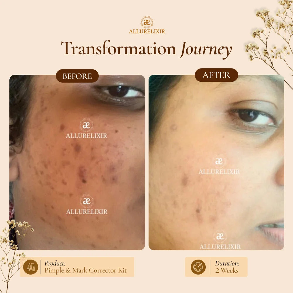 Brightening & Pimple Care Duo