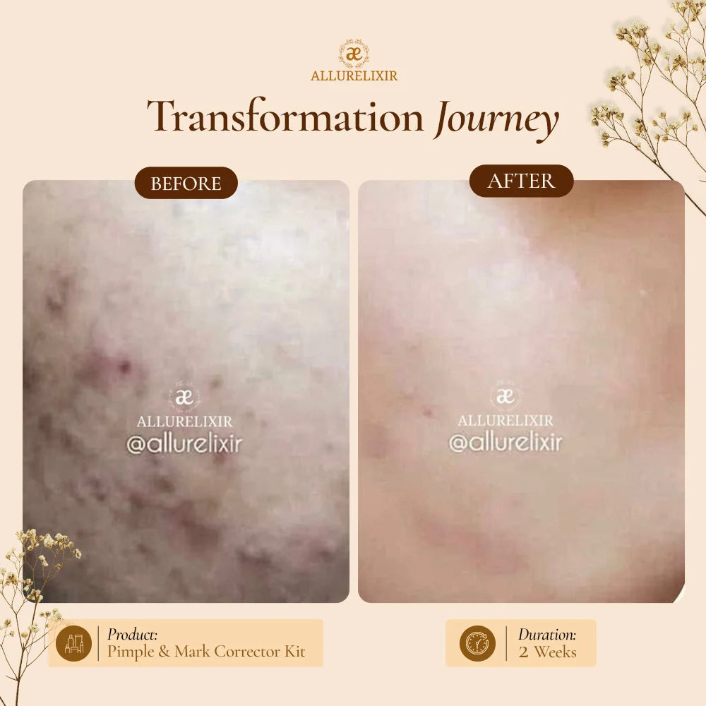 Brightening & Pimple Care Duo
