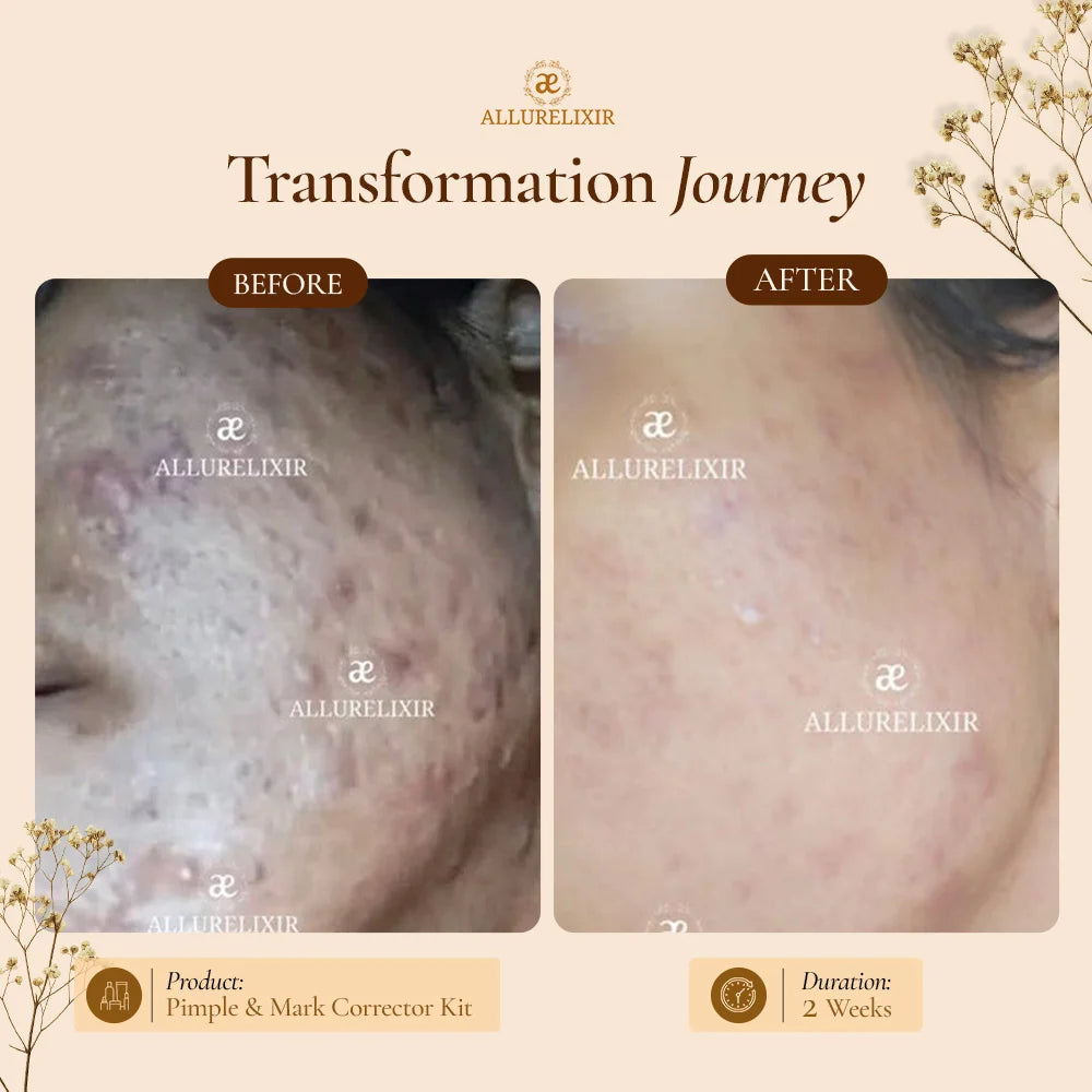 Brightening & Pimple Care Duo