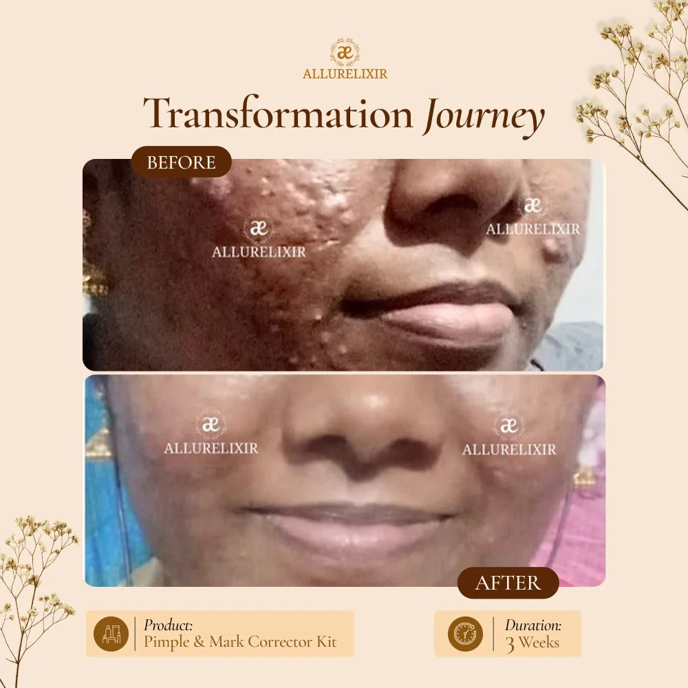Brightening & Pimple Care Duo