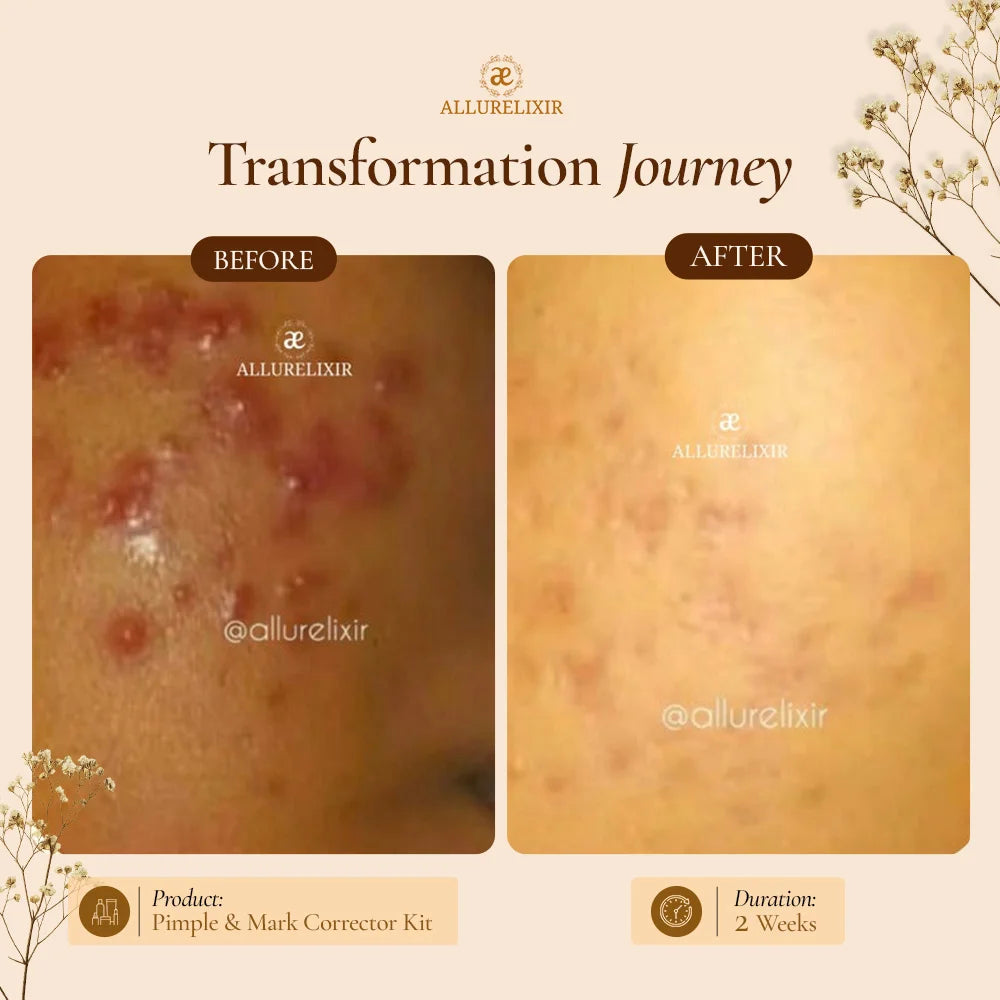 Brightening & Pimple Care Duo